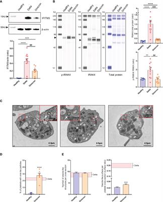 SARS-CoV-2 Omicron variant infection affects blood platelets, a comparative analysis with Delta variant